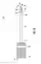 Fig. 02 - Valve core removal tool