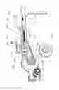 Fig. 02 - Kinetic log splitter