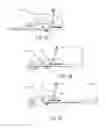 Fig. 06 - Kinetic log splitter