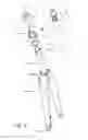 Fig. 10 - Suspension assembly and bicycle having a suspension assembly