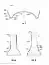 Fig. 03 - PROCESS TO MANUFACTURE LARGE FORMAT ALUMINUM BOTTLES