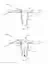 Fig. 04 - Disposable valve and flexible containers for pressurized bioreactors