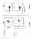 Fig. 07 - TCR Complex Immunotherapeutics