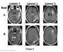 Fig. 09 - Methods for the treatment of vascularizing cancers