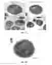 Fig. 16 - Polyamide nanoparticles and uses thereof
