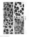 Fig. 22 - Polyamide nanoparticles and uses thereof