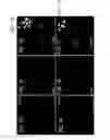 Fig. 04 - DOWNREGULATION OF miR-7 FOR PROMOTION OF BETA CELL DIFFERENTIATION AND INSULIN PRODUCTION