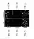 Fig. 10 - DOWNREGULATION OF miR-7 FOR PROMOTION OF BETA CELL DIFFERENTIATION AND INSULIN PRODUCTION