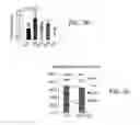 Fig. 11 - DOWNREGULATION OF miR-7 FOR PROMOTION OF BETA CELL DIFFERENTIATION AND INSULIN PRODUCTION