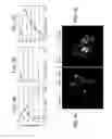 Fig. 14 - DOWNREGULATION OF miR-7 FOR PROMOTION OF BETA CELL DIFFERENTIATION AND INSULIN PRODUCTION
