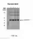 Fig. 08 - Downstream processing of an alkaline phosphatase