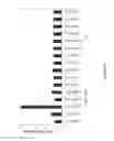 Fig. 28 - Compositions and methods for inhibition of nucleic acids function