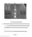 Fig. 05 - Method and kit for non-invasively detecting EGFR gene mutations