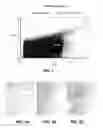 Fig. 02 - MicroRNA expression in human peripheral blood microvesicles and uses thereof