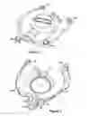 Fig. 02 - Secondary engine covers