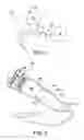 Fig. 02 - Combustor assembly for a gas turbine engine and method of making same