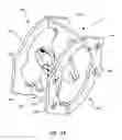 Fig. 07 - Resetting gun target