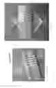 Fig. 12 - Electrophoresis system with modular pedestals