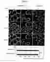 Fig. 08 - Biomarker for parkinson's disease and use thereof