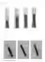Fig. 03 - Erythrocyte sedimentation inhibitor
