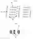 Fig. 04 - Low loss acoustic wave sensors and tags and high efficiency antennas and methods for remote activation thereof