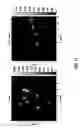 Fig. 22 - Beta and alpha emission tomography for three-dimensional autoradiography