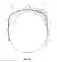 Fig. 08 - Adding prescriptive correction to eyepieces for see-through head wearable displays
