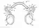 Fig. 01 - DEVICE FOR ELEVATING EYEGLASSES