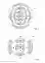 Fig. 03 - Multifocal ophthalmic lens to be worn in or on the eye