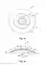 Fig. 02 - Means for controlling the progression of myopia