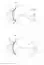 Fig. 03 - Multifunction contact lens