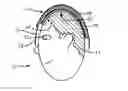 Fig. 01 - Method and apparatus for mapping a region of a body