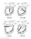 Fig. 05 - Performance of an operation based at least in part on tilt of a wrist worn apparatus