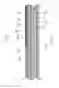 Fig. 35 - Touch screen stack-ups