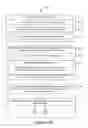 Fig. 87 - Methods and devices for adjusting chart magnification asymmetrically