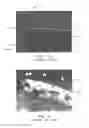 Fig. 05 - Method and apparatus for automated platelet identification within a whole blood sample from microscopy images
