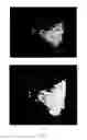 Fig. 09 - Three-dimensional cavitation quantitative imaging method for microsecond-resolution cavitation spatial-temporal distribution