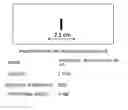 Fig. 01 - Method and apparatus for measuring an ultrasonic image