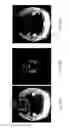 Fig. 28 - Method, apparatus, and computer readable medium for removing unwanted objects from a tomogram