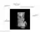 Fig. 01 - Methods and systems for three-dimensional visualization of deviation of volumetric structures with colored surface structures