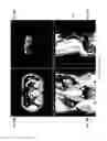 Fig. 15 - Methods and systems for three-dimensional visualization of deviation of volumetric structures with colored surface structures