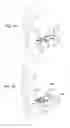 Fig. 02 - Spacer and hearing device comprising it
