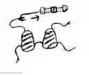 Fig. 01 - Bikini buddy