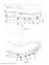 Fig. 02 - Protection device