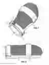 Fig. 02 - Restraint Mitten