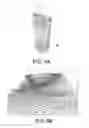 Fig. 08 - METHODS FOR DESIGNING A FOOT ORTHOTIC