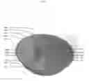 Fig. 06 - Disposable Divided Bowls