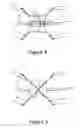 Fig. 05 - Adjustable device to aid in human fecal matter evacuation