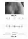 Fig. 12 - Apparatus and methods for determining damaged tissue using sub-epidermal moisture measurements