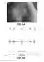 Fig. 12 - Apparatus and methods for determining damaged tissue using sub-epidermal moisture measurements